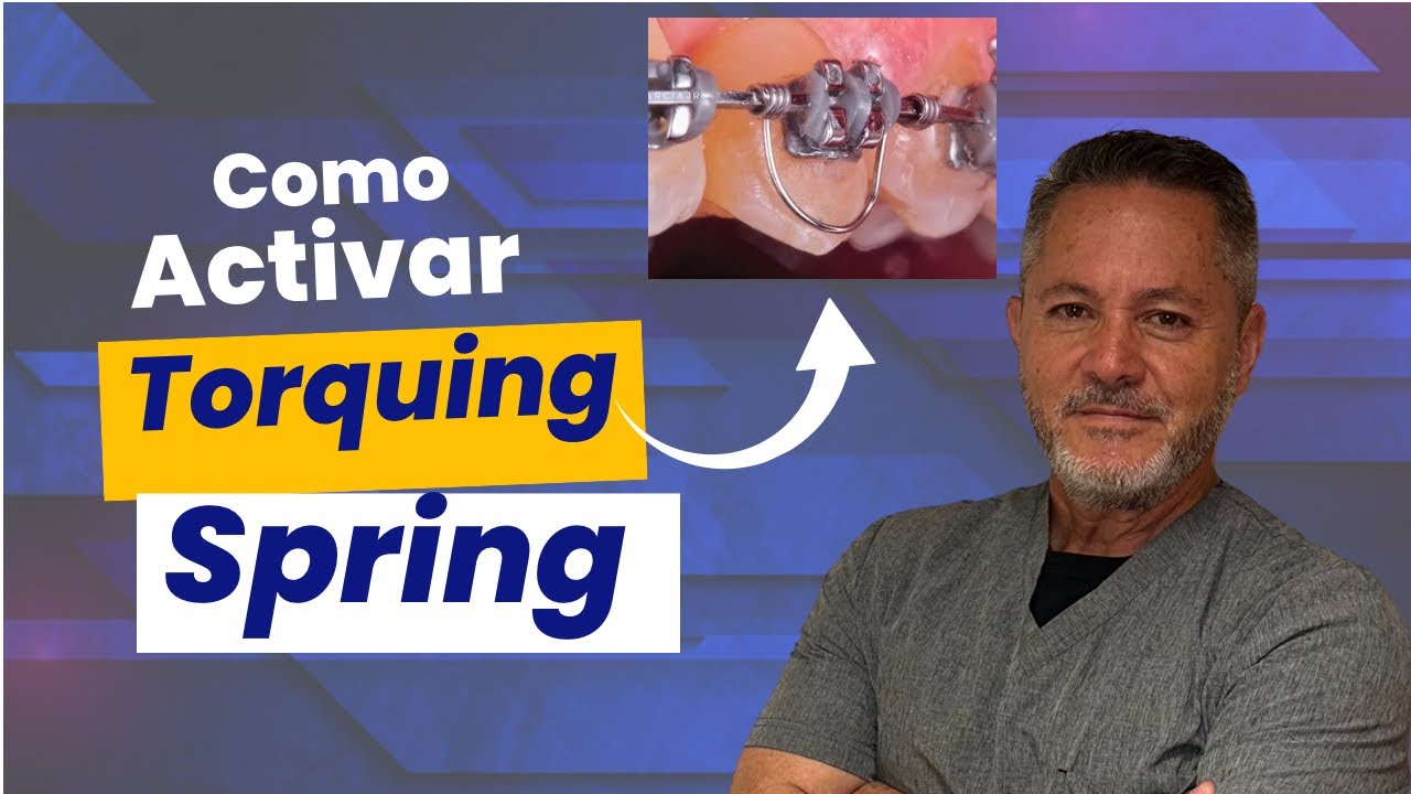 Como activar un torquing spring en la consulta