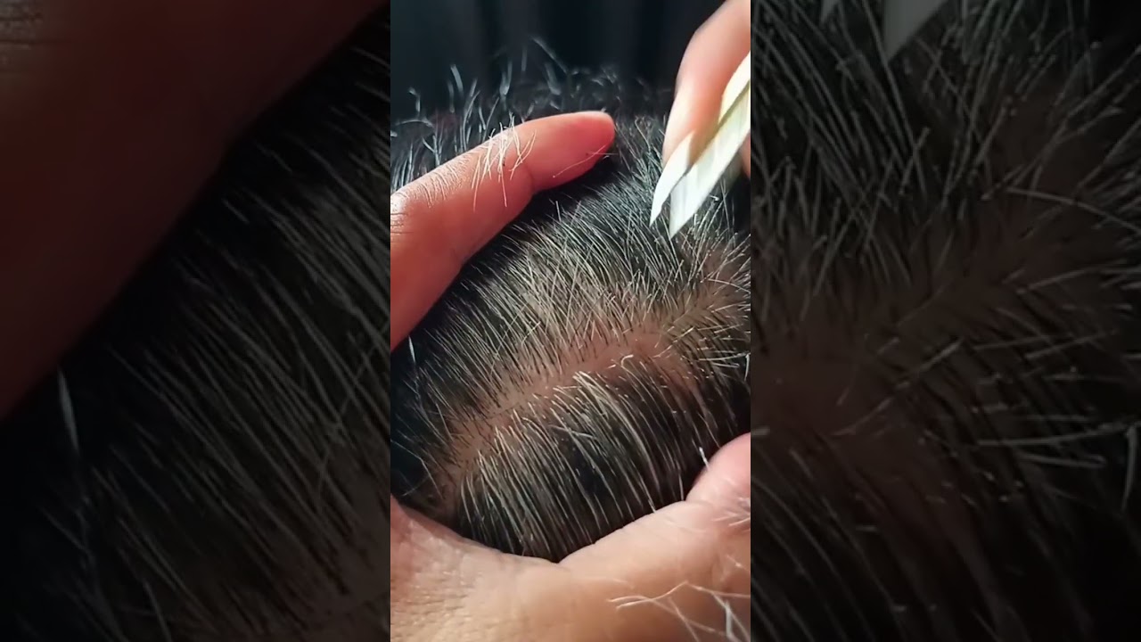 Самое приятное удаление седых волос #51 #музыка #удовлетворение #снятиестресс