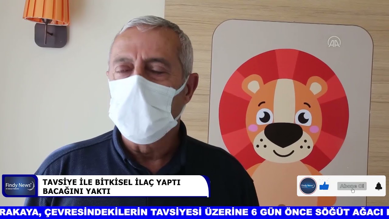 TAVSİYE İLE BİTKİSEL İLA&Ccedil; YAPTI BACAĞINI YAKTI