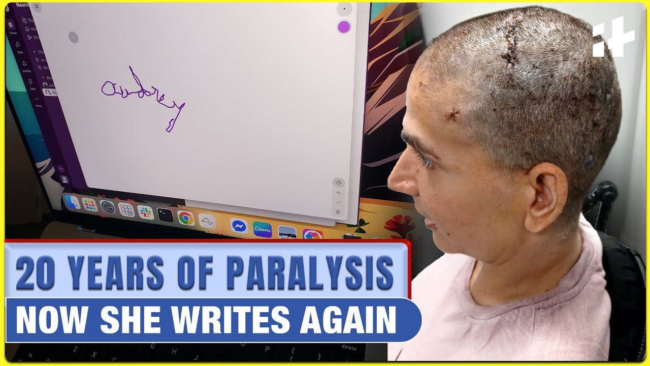 Neuralink Brain Chip Helps Paralysed Patient of 20 Years Write Telepathically