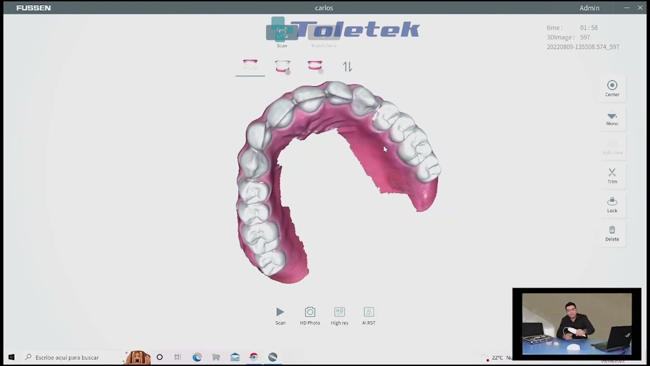 🦷Escaner Intraoral FUSSEN S6000 🦷 (Manejo del software parte 2)