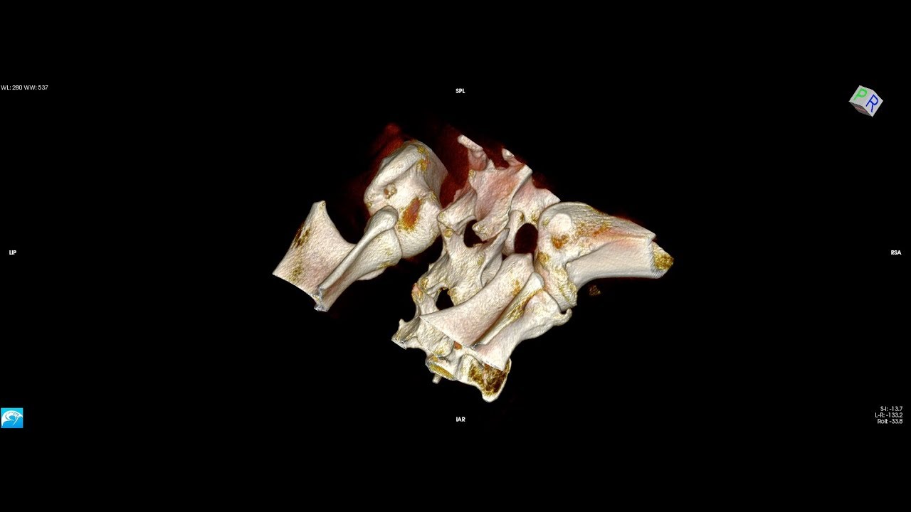 Canine Shoulders Osteochondrosis & Osteoarthrosis
