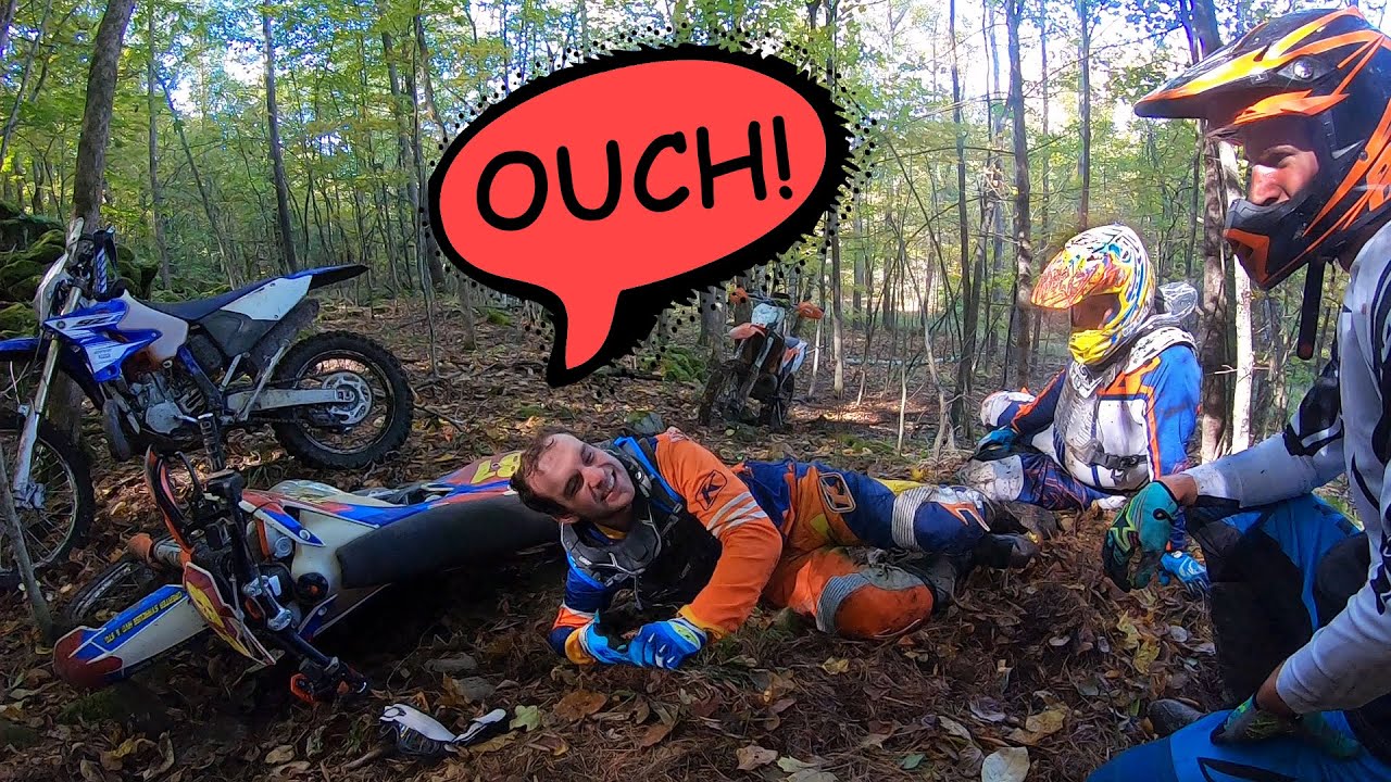 I BROKE MY FOOT - DIRT BIKE ACCIDENT