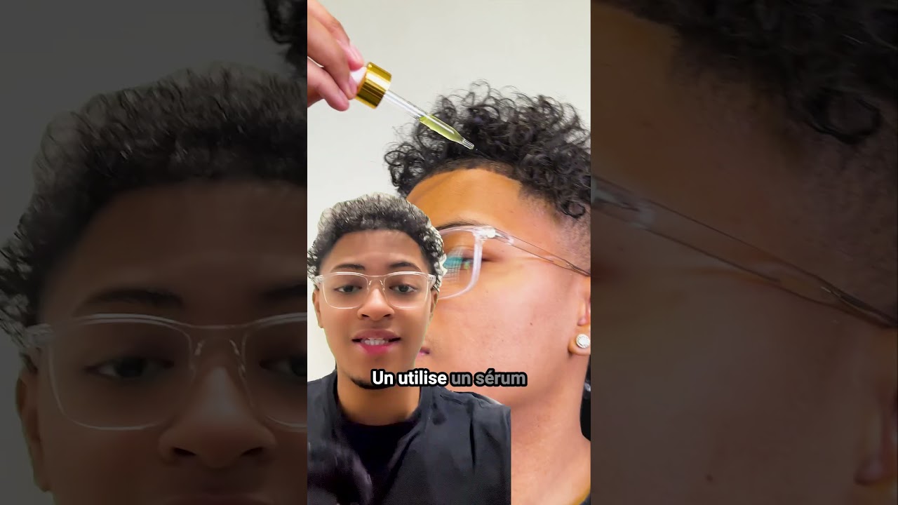 Comment ne pas avoir la calvitie  