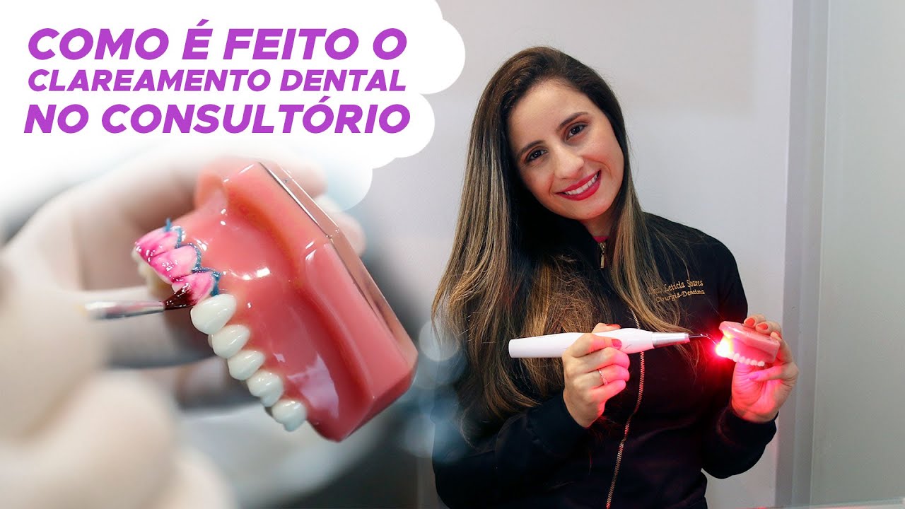 COMO É FEITO O CLAREAMENTO DENTAL NO CONSULTÓRIO