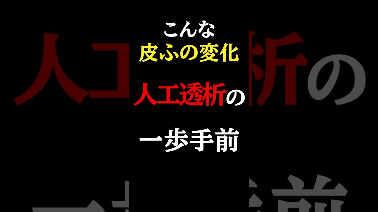 【知らないと危険】こんな「皮ふの変化」腎臓が悪いサイン#医師#人工透析#予防医学チャンネル