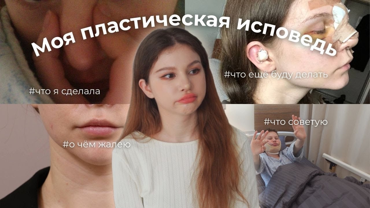 ВСЁ ПРО МОИ ПЛАСТИЧЕСКИЕ ОПЕРАЦИИ | ЧТО СДЕЛАЛА И О ЧЁМ ПОЖАЛЕЛА | МОЯ УЖАСНАЯ РИНОПЛАСТИКА