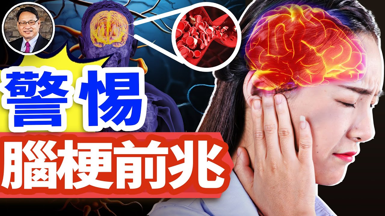 早上有這3個症狀，當心是腦梗警訊⚠️
