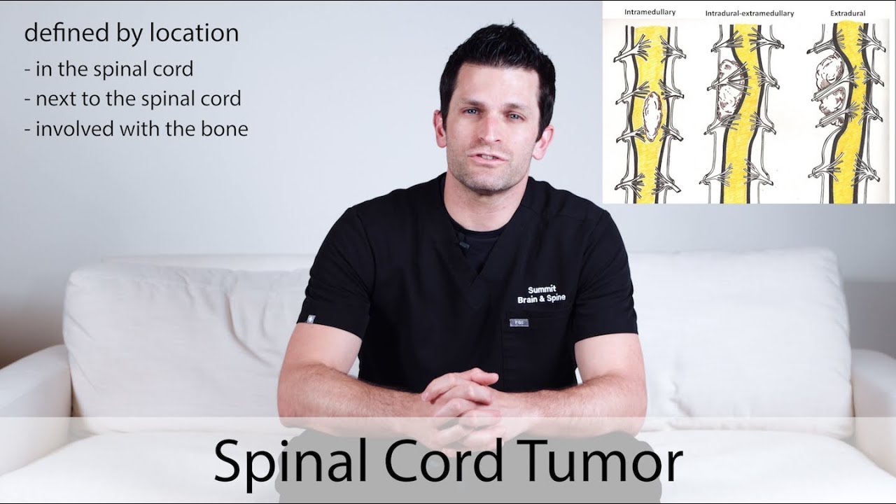 Spinal Cord Tumor