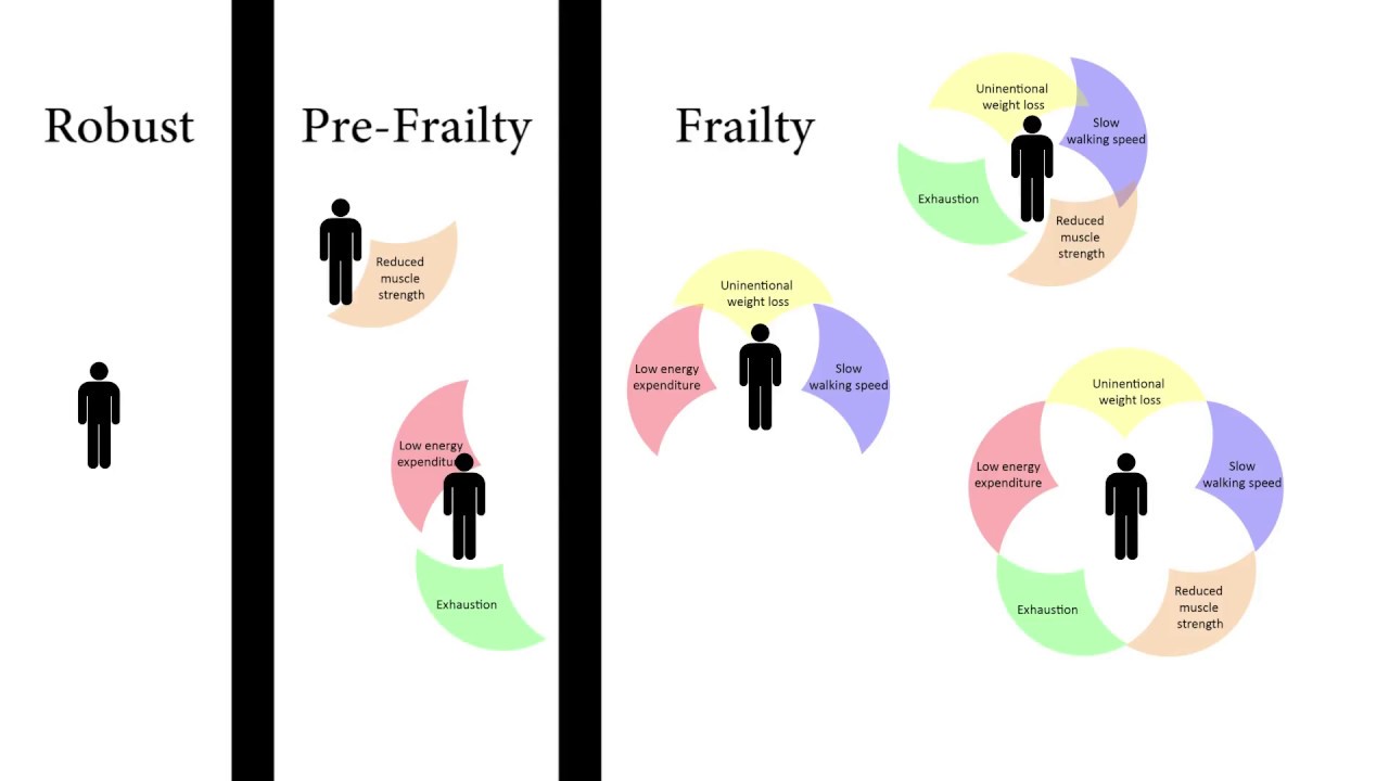 Measuring Fried's Frailty Phenotype