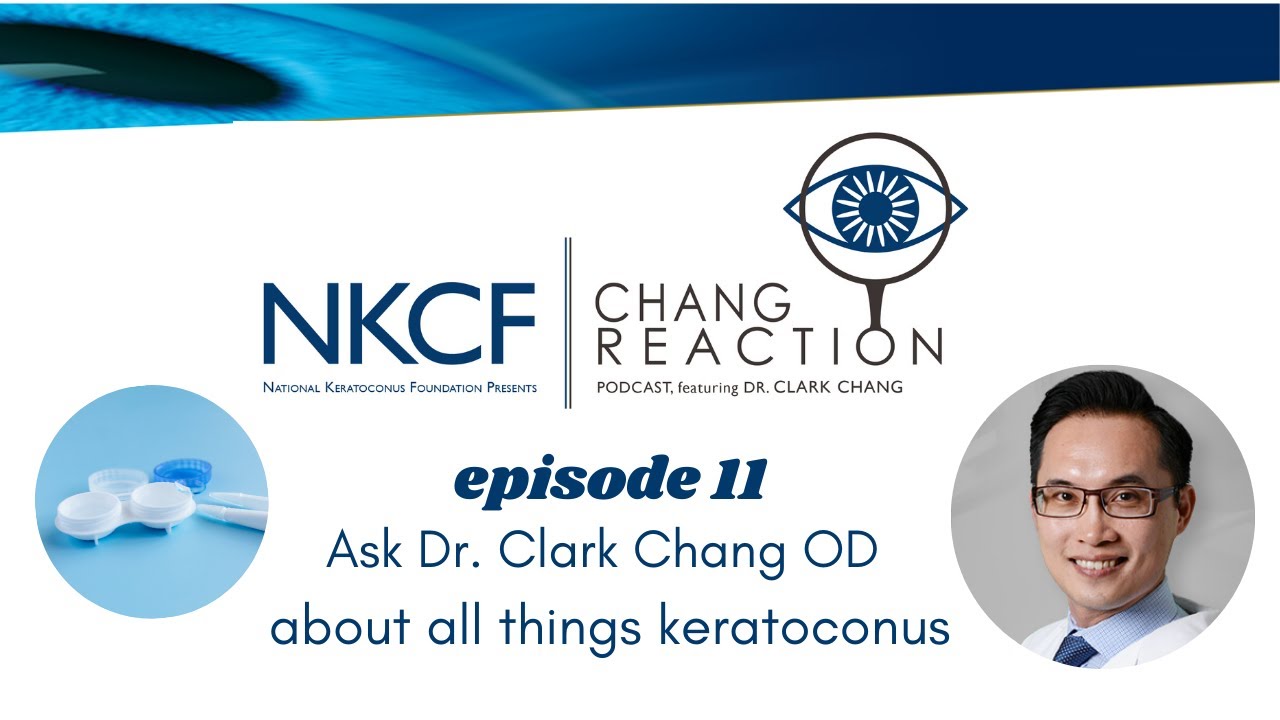 Chang Reaction Episode 11: What are my contact lens options for my abnormal cornea?