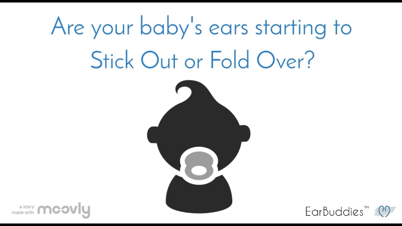 Fix Stick Out Ears at home with EarBuddies!
