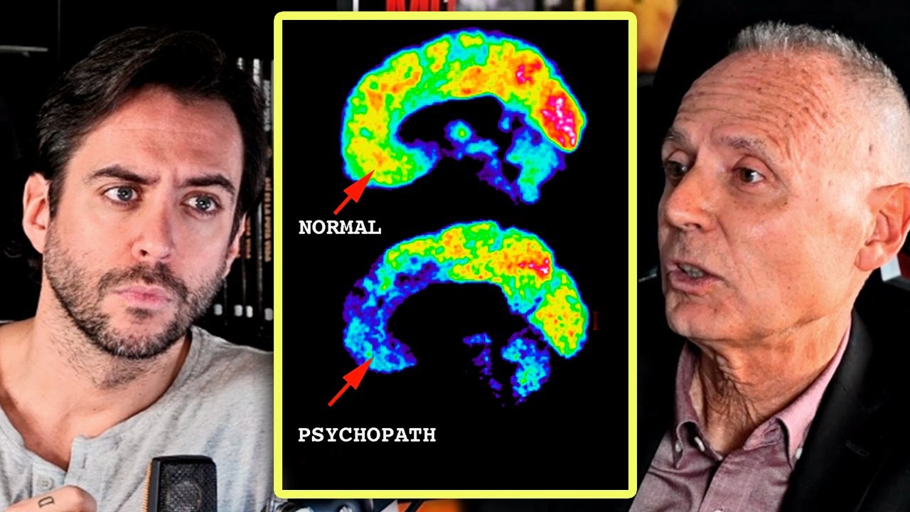 ¿UN PSICÓPATA NACE O SE HACE? - Psicólogo experto en crímenes lo explica