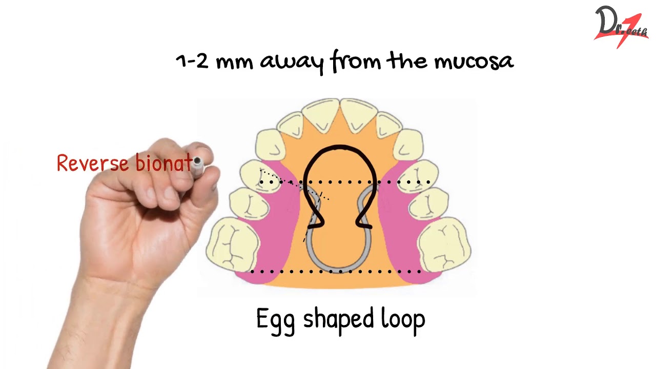 Parts of Bionator