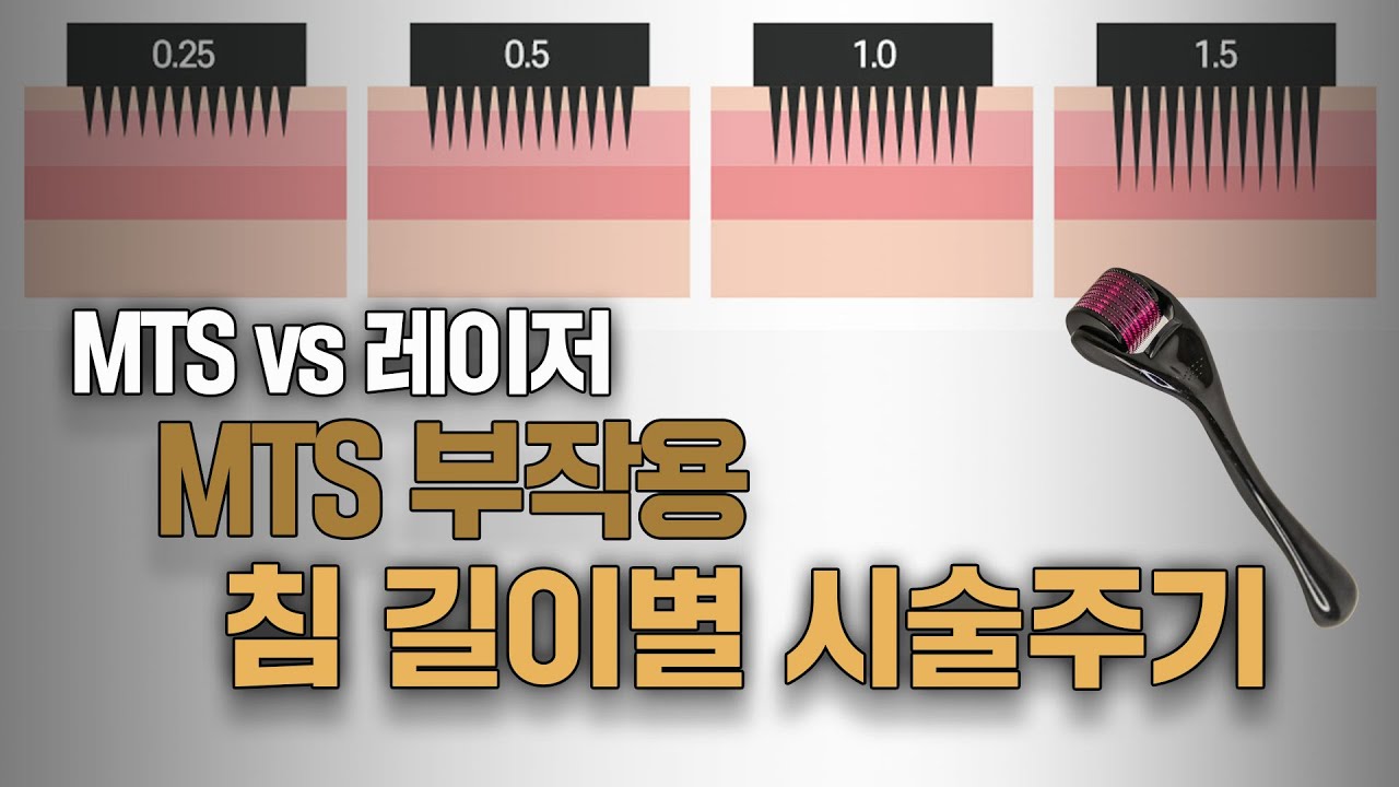 MTS 침길이별 효과 or 부작용 | MTS 전문채널 NO.1 MTS전도사