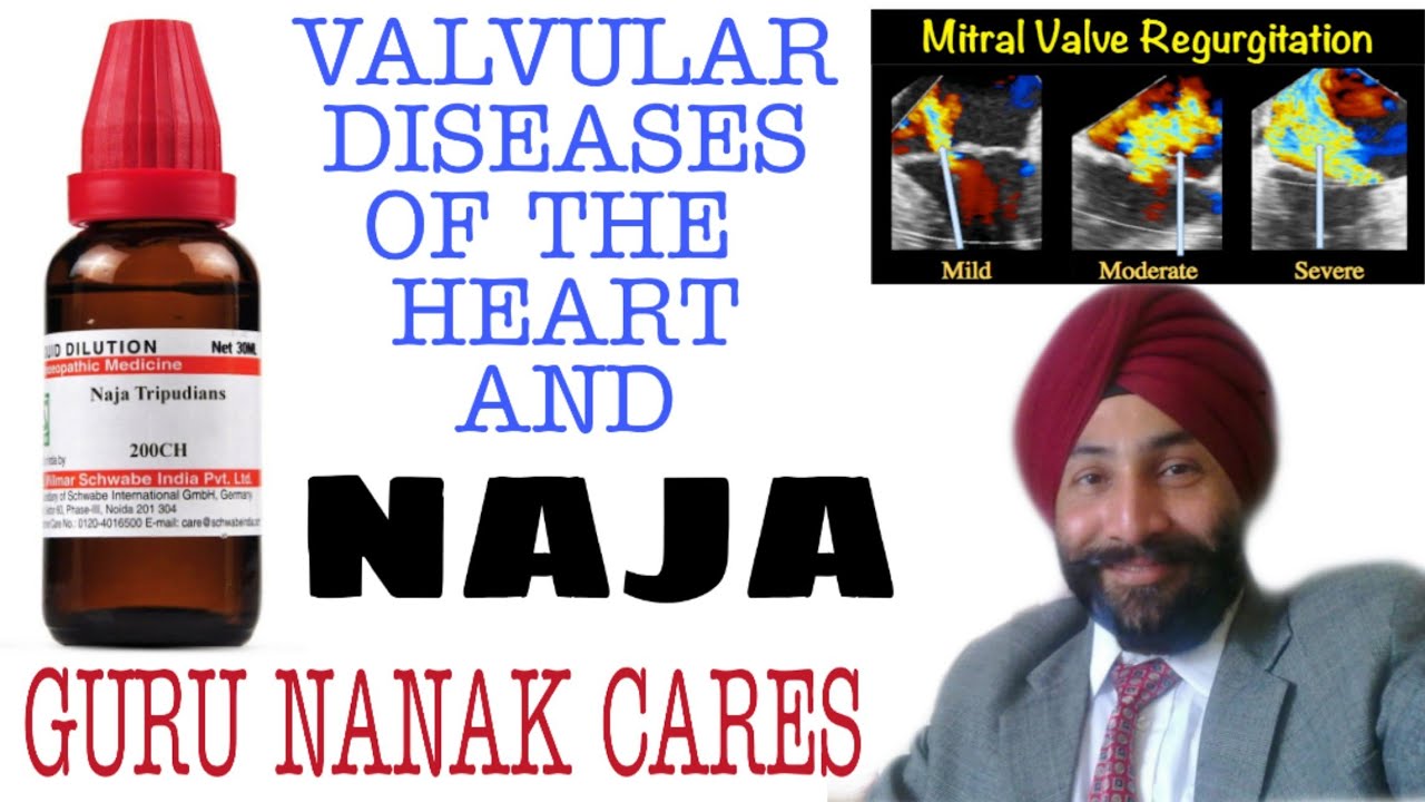 हार्ट के वाल्व्स का बेस्ट इलाज | ROLE OF NAJA IN VALVULAR DISEASES OF THE HEART