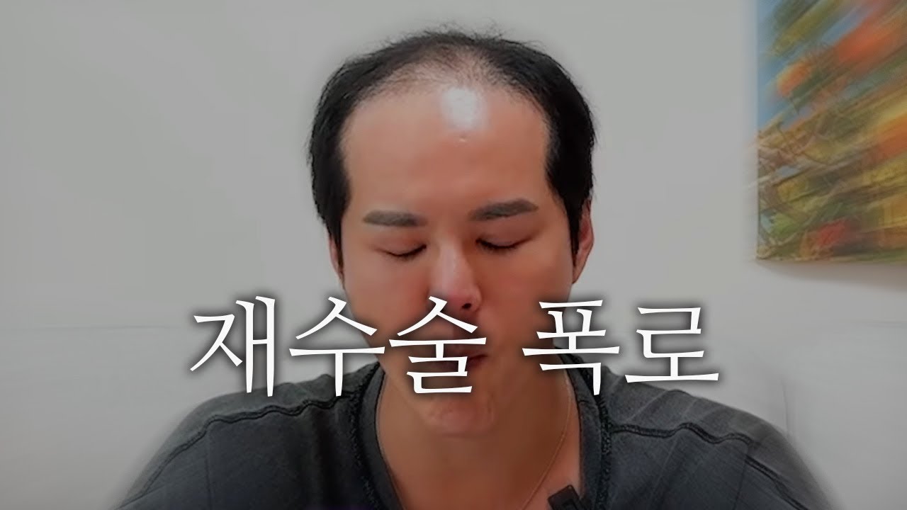 [모발이식] 의사가 폭로하는 재수술 실태