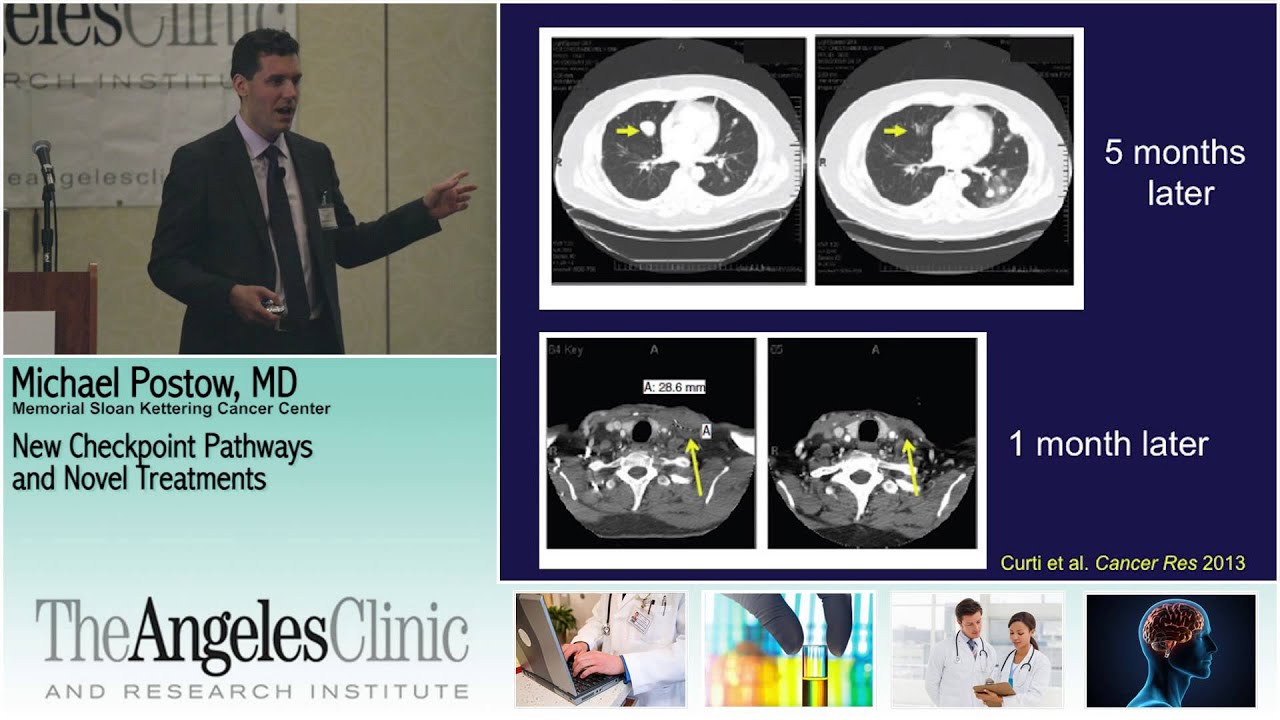 New Checkpoint Inhibitors & Immunotherapy in Metastatic Melanoma -   Michael Postow MD