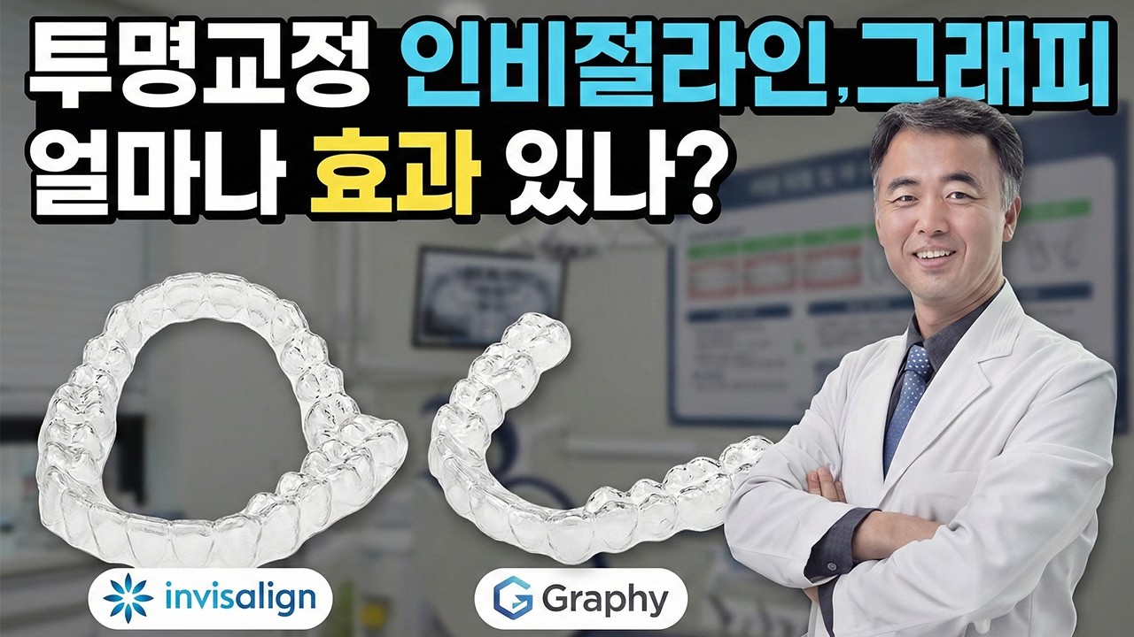 투명교정 인비절라인, 그래피 얼마나 효과있나?
