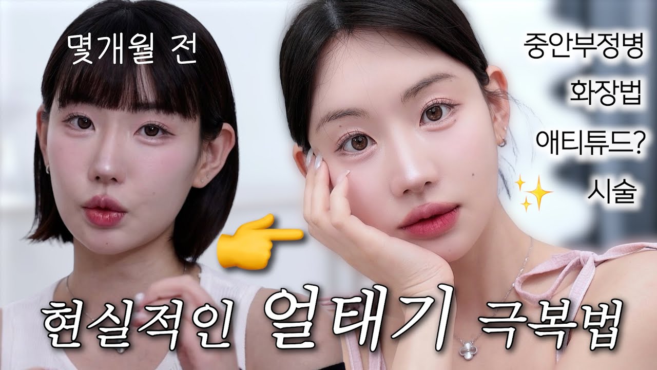 요즘 내 얼굴 맘에듦 🙈 얼태기 극복비법 8가지  | 예뻐지는법, 중안부정병,마인드세팅,시술,화장법,컴플렉스 …