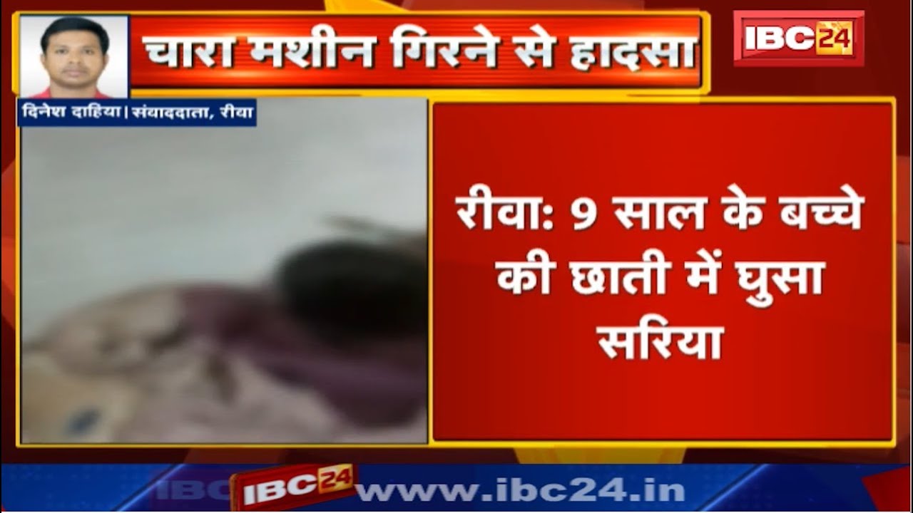 Rewa News MP : 9 साल के बच्चे की छाती में घुसा सरिया | Chara Machine गिरने से हुआ हादसा