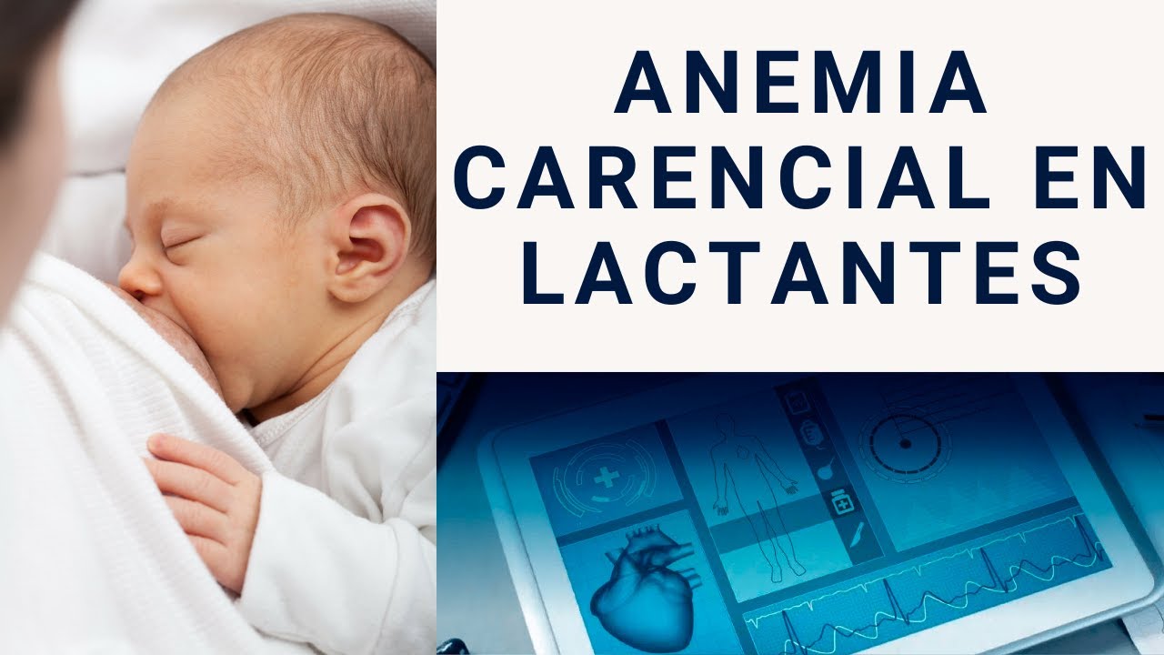 ANEMIA CARENCIAL EN LACTANTES