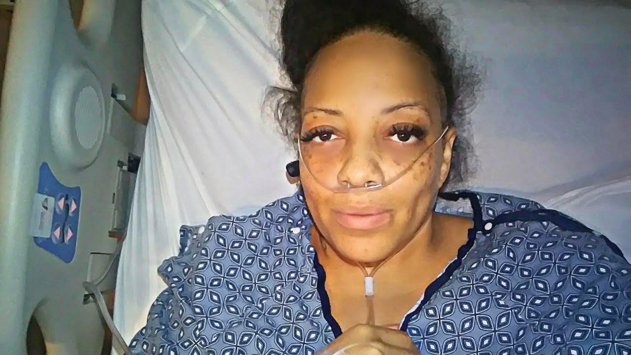 TOTAL ABDOMINAL HYSTERECTOMY  POST OP SURGERY  Week 1 thru 3 VLOG What To EXPECT & DON'T TELL YOU