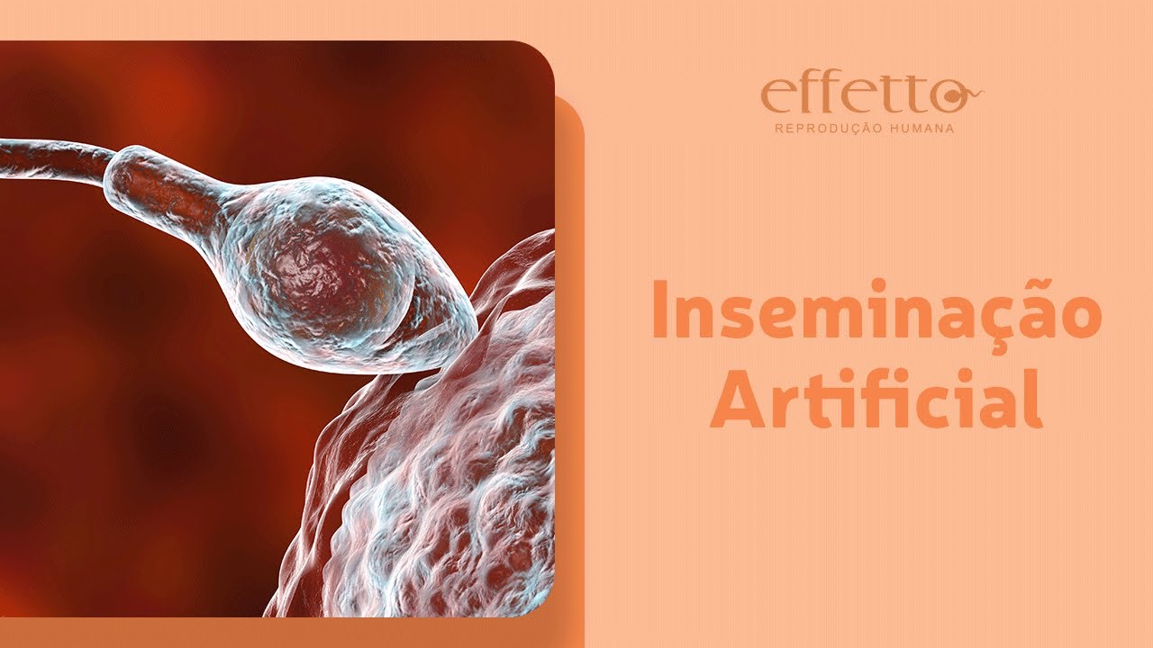 Inseminação artificial: quando é indicada e como é feita
