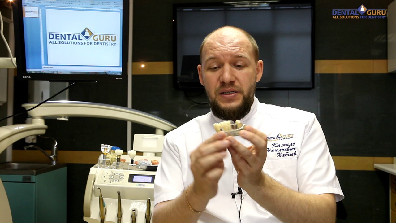 Как проводится имплантация. Этапы и последовательность?