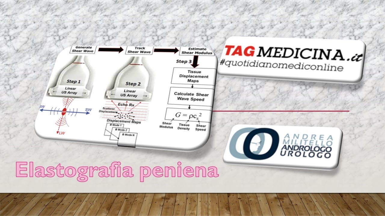 In arrivo un nuovo esame per lo studio della disfunzione erettile