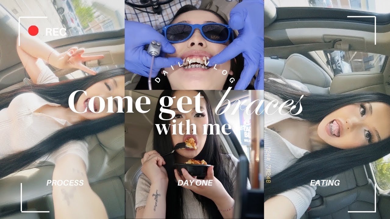 Braces Vlog Ep.1: GETTING BRACES FOR THE FIRST TIME!!! 🦷🪥
