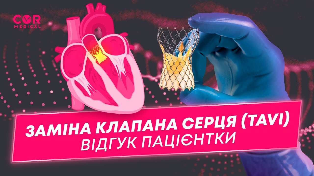 Малоінвазивне протезування аортального клапана (TAVI). Історія пацієнтки