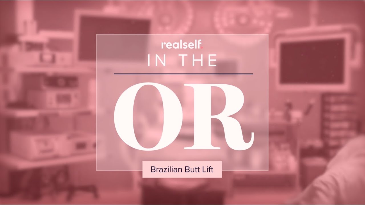 Planning for a Brazilian Butt Lift | In the OR (Part 1 of 3)