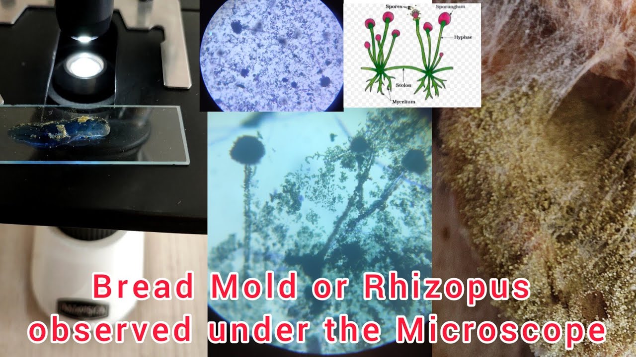 Bread Mold or Rhizopus observed under the Microscope #cbse #breadmold #biology #rhizopus