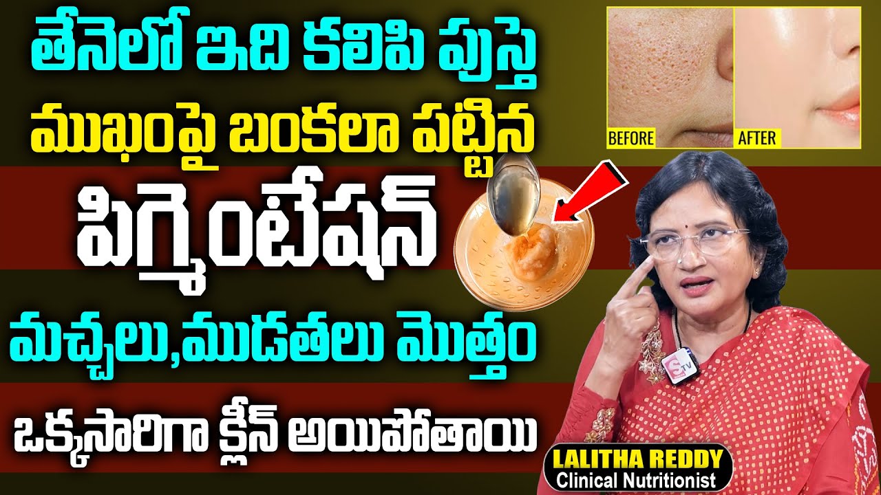 తేనెలో ఇది కలిపి రాస్తే ముఖం పై మంగు మచ్చలు ముడతలు మొత్తం పోతాయి | Lalitha Reddy | Pigmentation