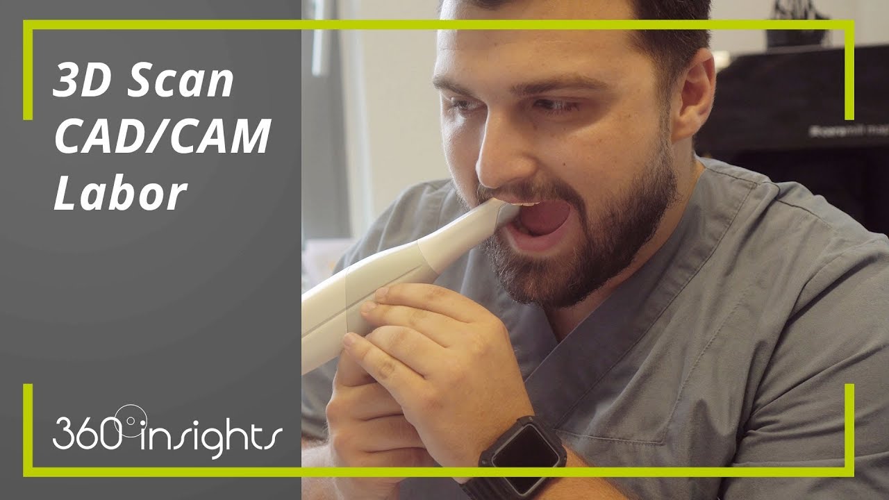 3D Scan im CAD/CAM Labor mit Zahntechniker Haris | 360°zahn Insights