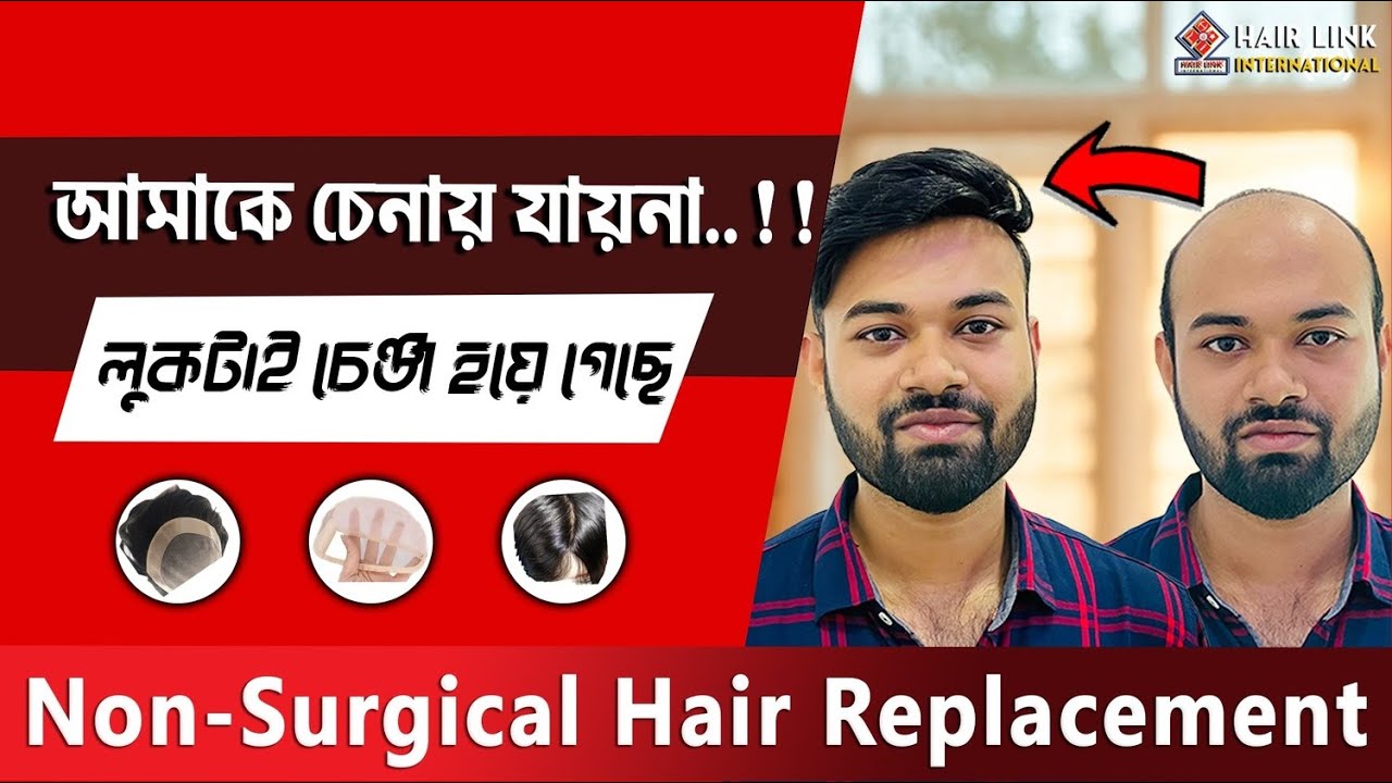 আরিফ - নোয়াখালী থেকে | Hair System for Men | HAIR LINK INTERNATIONAL