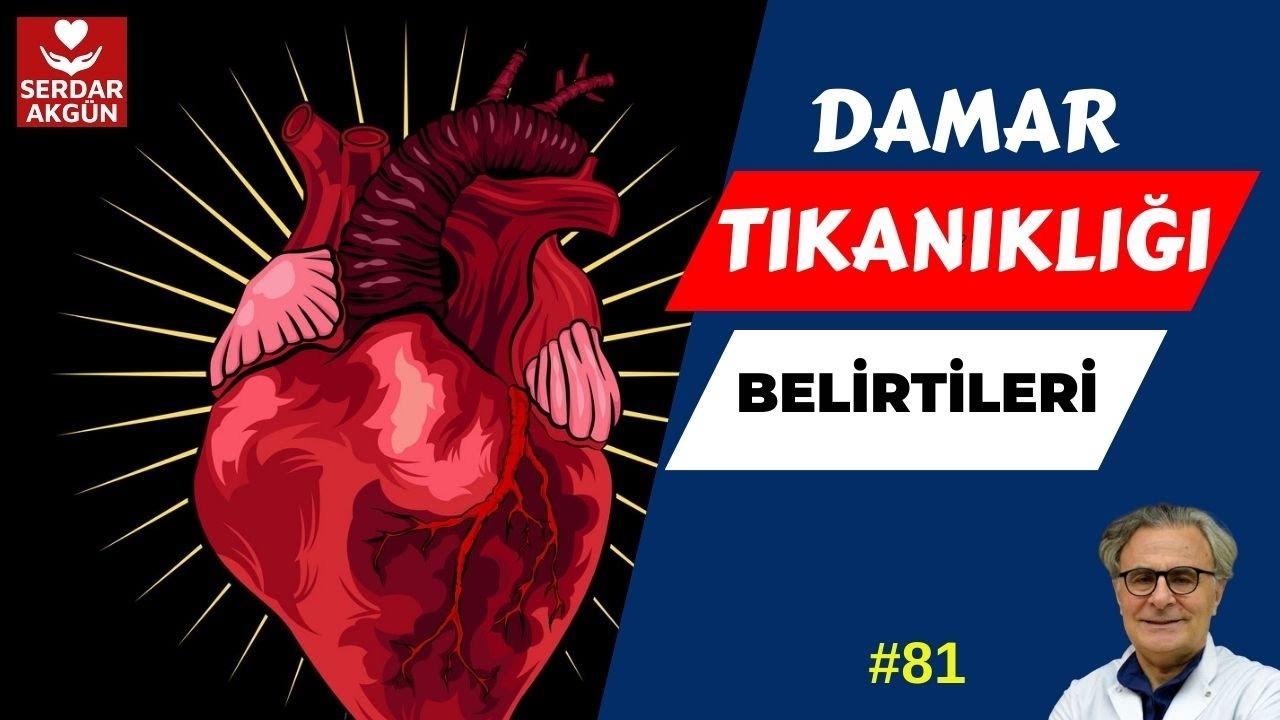 81. Damar tıkanıklığı belirtileri nelerdir? Sağlık Videoları, SERDAR AKGÜN