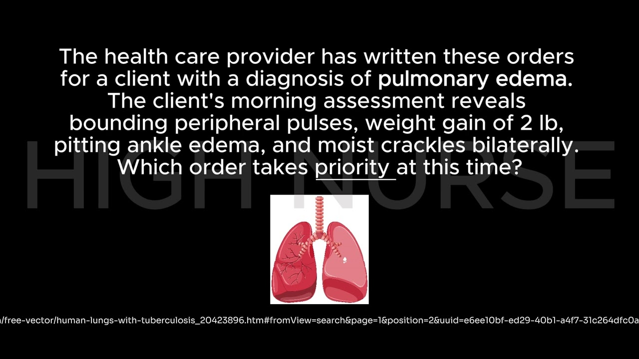 #nursing #nursingstudent #nursingexam #nursinglectures #nclex_rn #nclexpass #nclexprep #nclexstudy