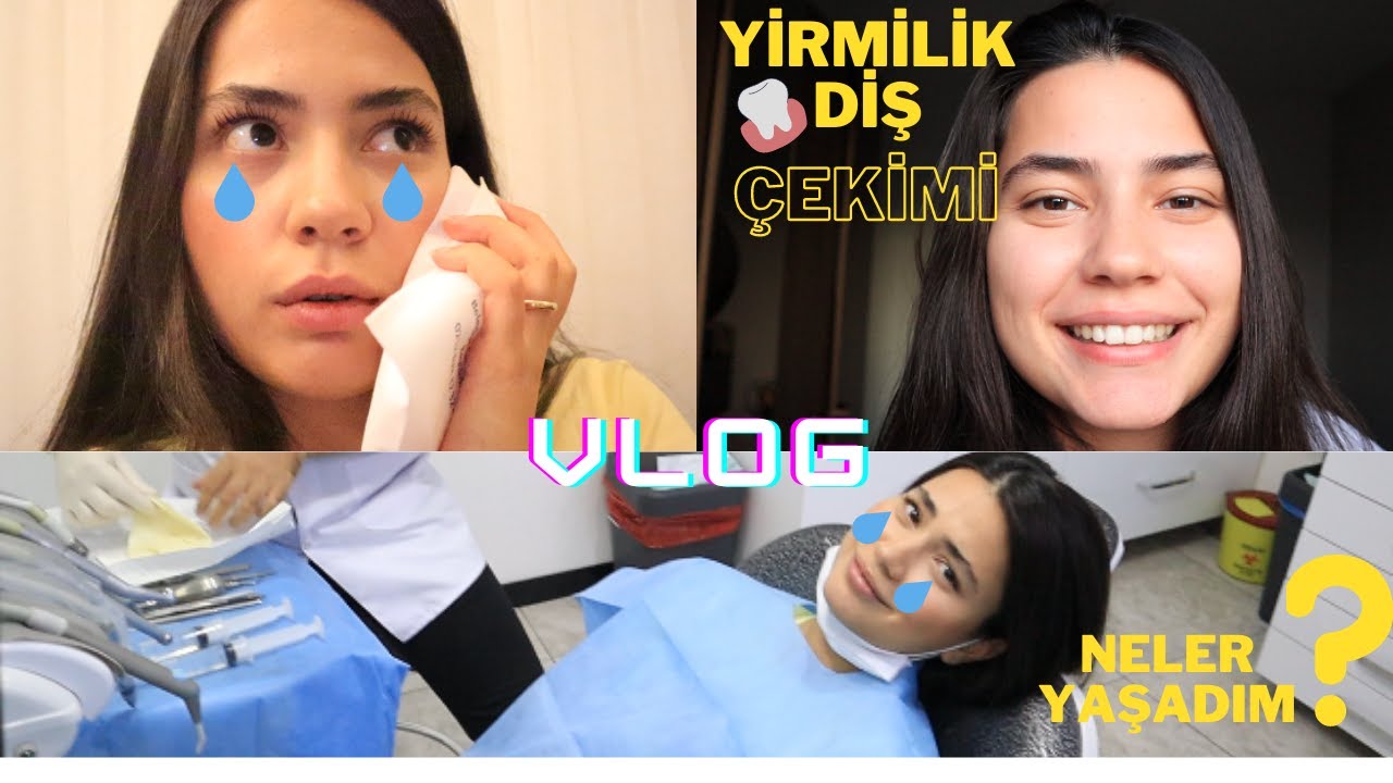 YİRMİLİK DİŞ &Ccedil;EKİMİ AMELİYATIM NASIL OLDU?🦷|NELER YAŞADIM😢?|İYİLEŞME S&Uuml;RECİM| #yirmilikdiş #g&ouml;m&uuml;l&uuml;