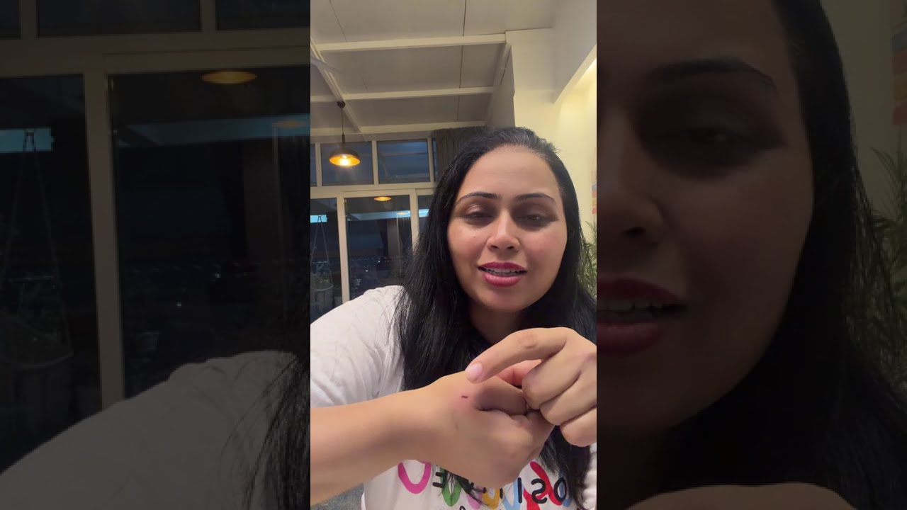 Ye kya hua dekho #foryou #petshub #youtube #pets #live #livestream 