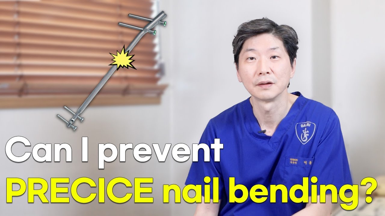 [ENG]  How common is the nail bending in PRECICE leg lengthening?