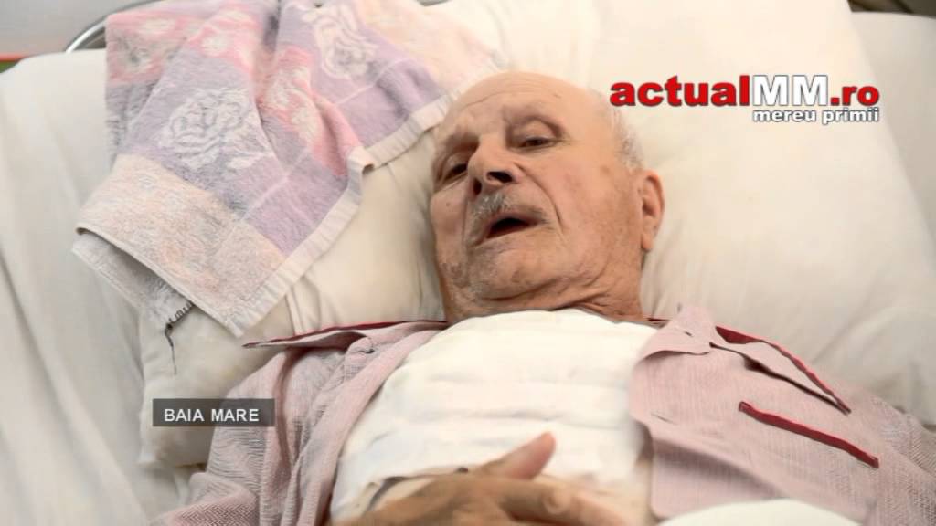 tumora gigant spitalul baia mare actualmm