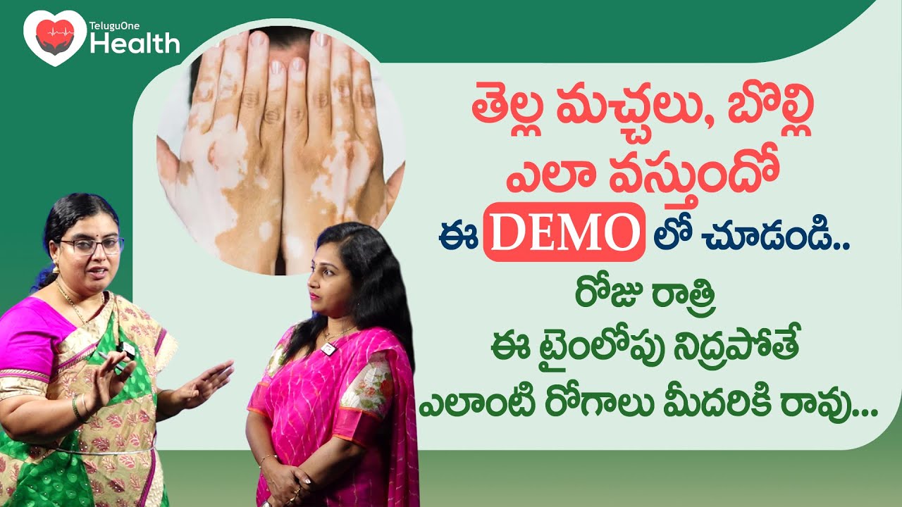 Bolli, Vitiligo DEMO | తెల్ల మచ్చలు, బొల్లి ఎలా వస్తుందో.. Unani Dr. SGV Sathya | TeluguOne Health