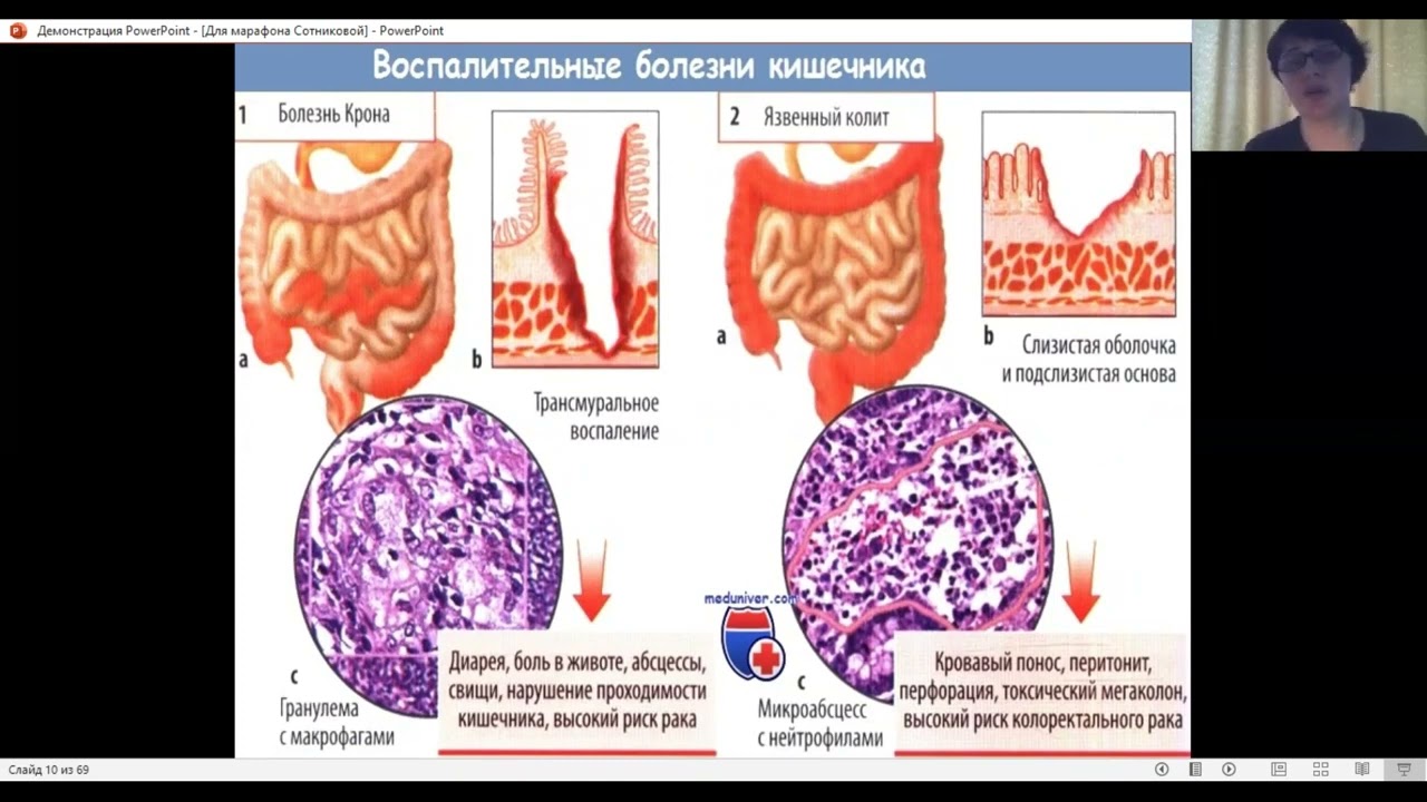 Восстановление микрофлоры кишечника. Пробиотики, симбиотики ЭМ-курунга, куэмсил