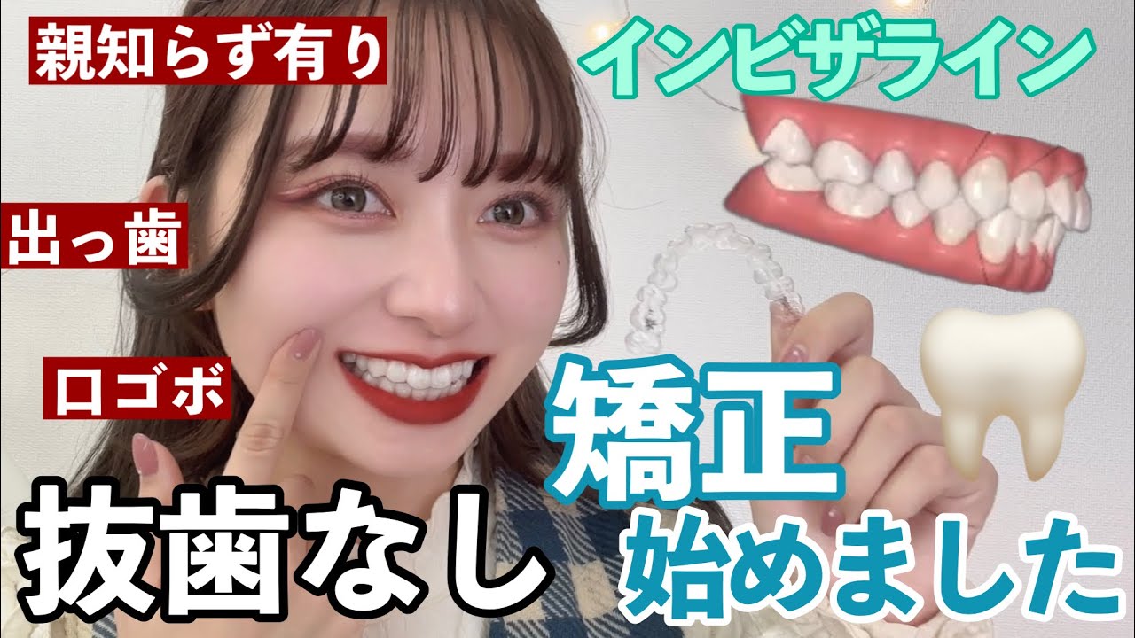 【歯列矯正】出っ歯/口ゴボ24歳女、抜歯なしのインビザライン矯正はじめたので正直レビューします（親知らずもまだいる）【金額とデメリットも話すよ】