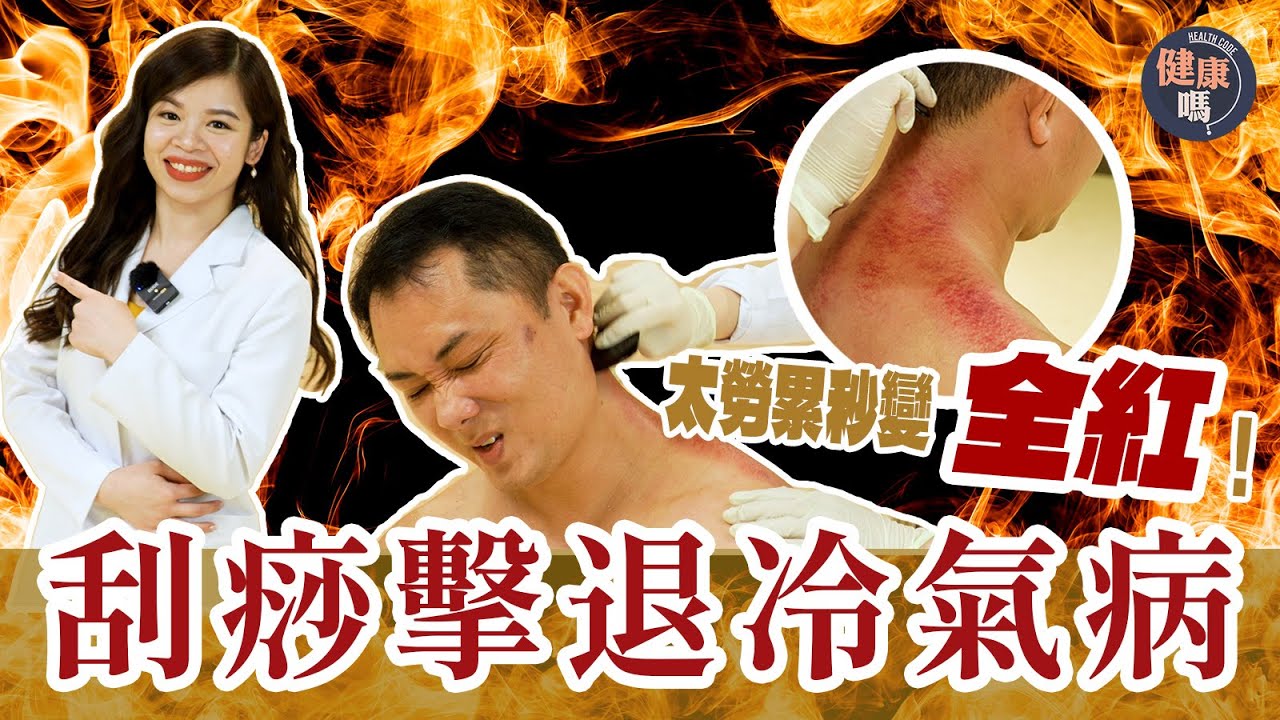 常歎冷氣一身都是病｜刮痧袪濕清毒最有效｜居家刮痧必學5個技巧｜健康嗎 @HealthCodeHK 【實測師】