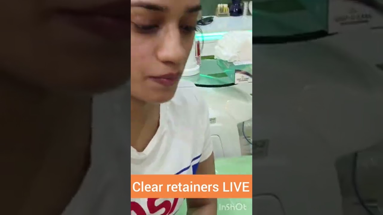 CLEAR Retainer (LIVE): Dr. Srishti Bhatia #braces #retainer