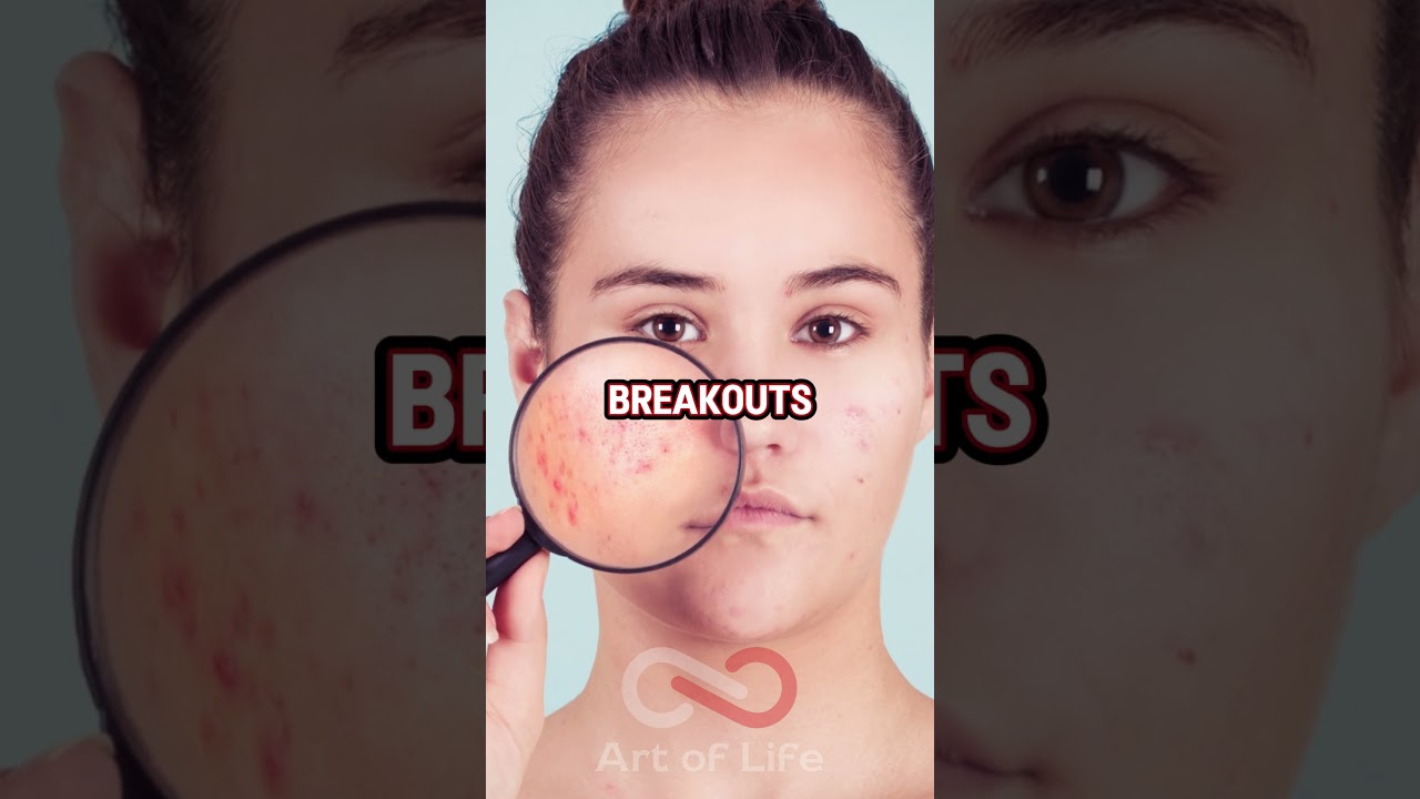 Excessive Sugar Consumption Is Seriously Damaging Your Skin