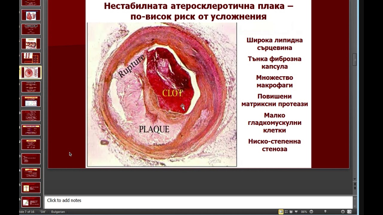 Сърдечно съдова система  - патоанатомия - Ночева.
